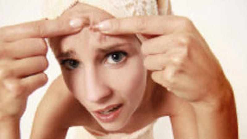 Cum previi cicatricile lasate de acnee