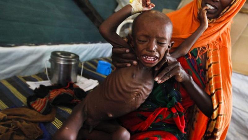 IMAGINI SOCANTE! Somalia: 500.000 de copii, in pragul mortii din cauza foametei