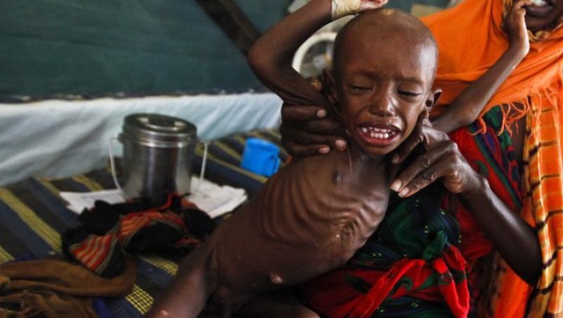 IMAGINI SOCANTE! Somalia: 500.000 de copii, in pragul mortii din cauza foametei