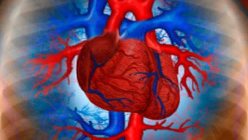 Romania, pe locul 3 in lume in ceea ce priveste mortalitatea din cauze cardiovasculare