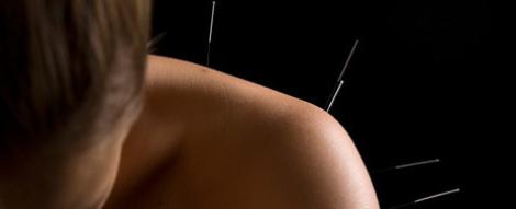 Acupunctura, benefica in orice anotimp