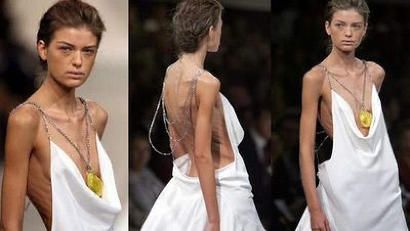 SOCANT! Manechine anorexice la saptamana modei de la Milano
