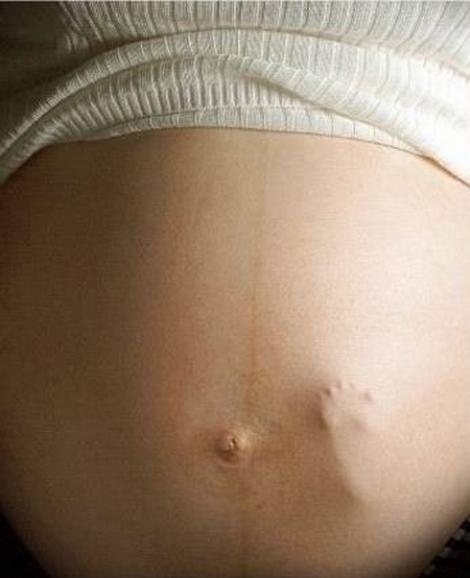 Opt ciudatenii pe perioada sarcinii