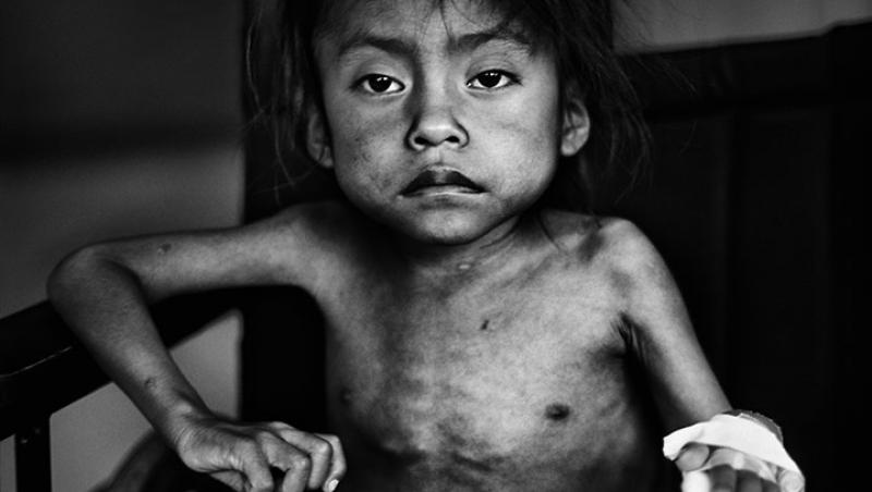 FOTO! UNICEF a ales fotografiile anului 2011