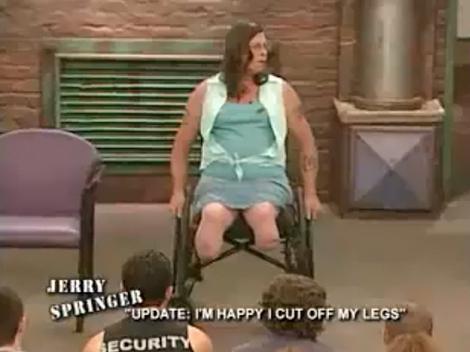 VIDEO! Un transsexual si-a amputat picioarele, pentru ca era nefericit cu ele!