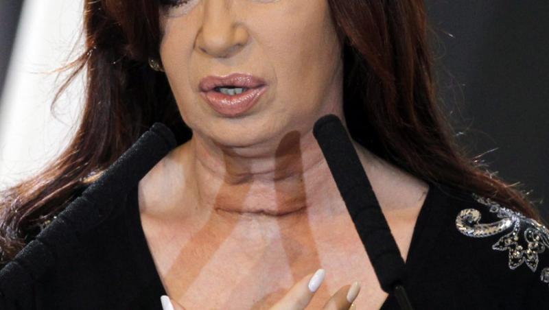 Presedintele Argentinei a dezvaluit cicatricea din urma operatiei la gat
