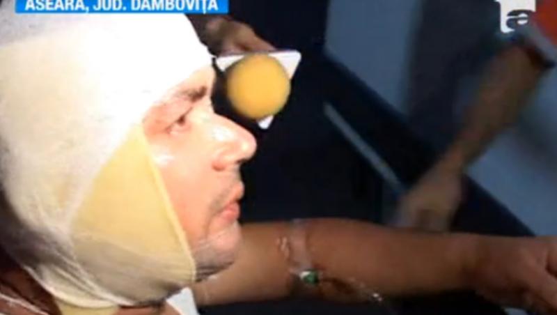 Dambovita: Un politist i-a aruncat cu acid in fata unui vecin