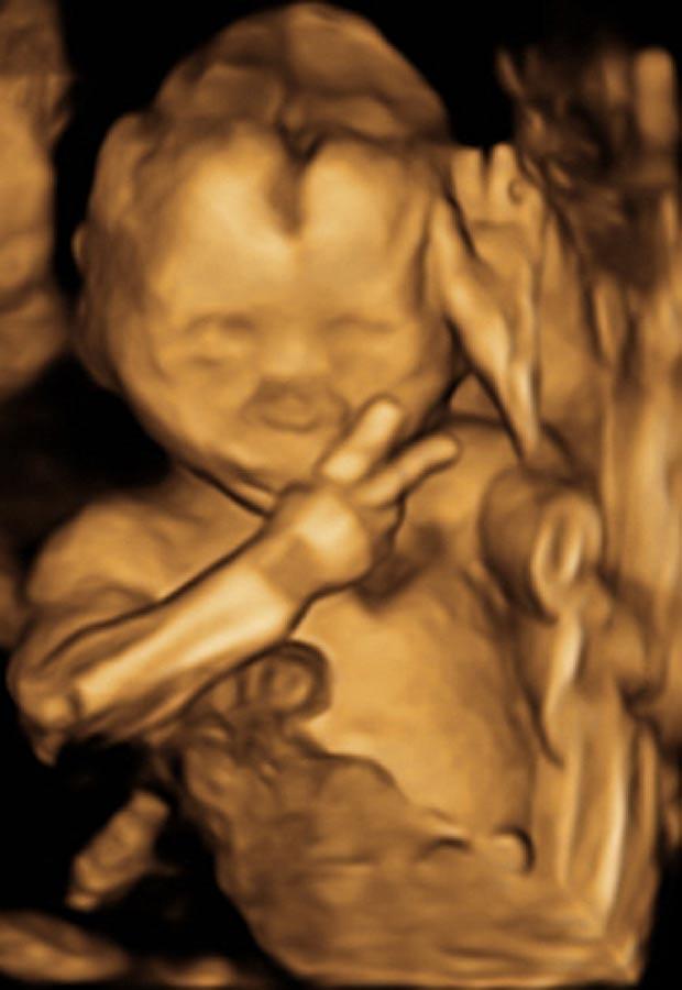 Un bebelus arata semnul victoriei in pantecele mamei. Momentul, surprins la o ecografie