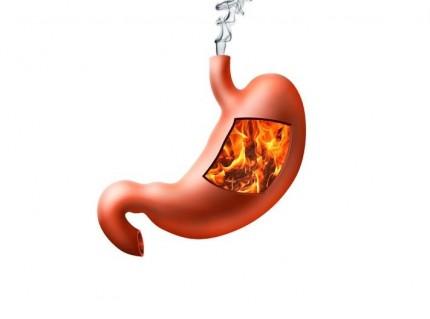  Ai arsuri gastrice? Iata 9 afectiuni grave ce pot avea aceleasi simptome