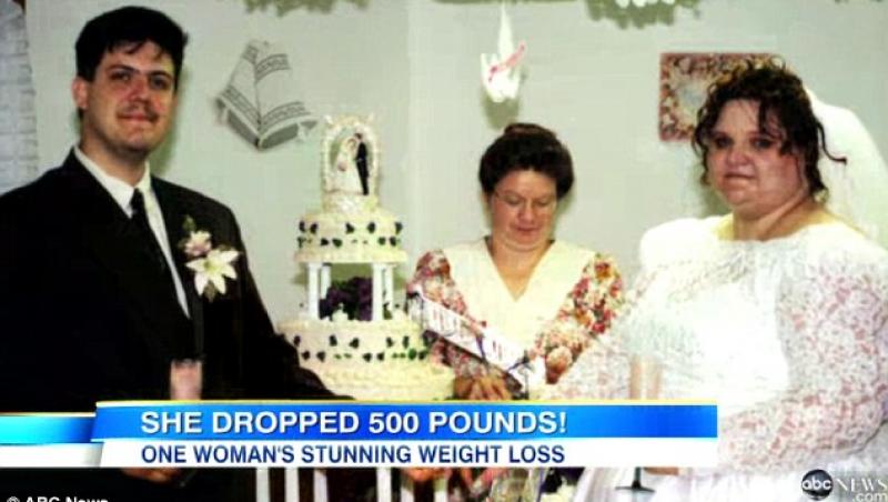 Transformare uluitoare: Vezi cum a slabit o femeie 226 de kilograme!