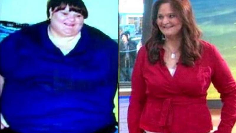 Transformare uluitoare: Vezi cum a slabit o femeie 226 de kilograme!