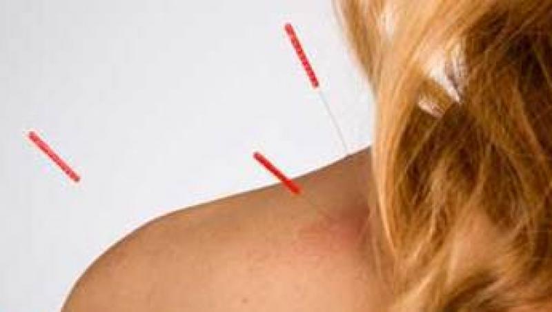 Acupunctura - 40% mai multe sanse pentru a ramane insarcinata