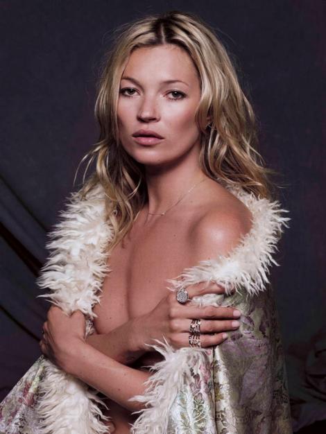 Kate Moss are bratul drept paralizat temporar!