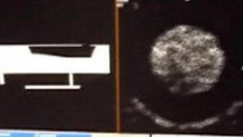 VIDEO! Aparat medical de un milion de euro, nefolosit din cauza limbii engleze