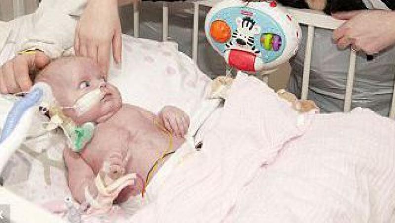 Premiera mondiala: bebelus de 17 ore, operat pe inima!