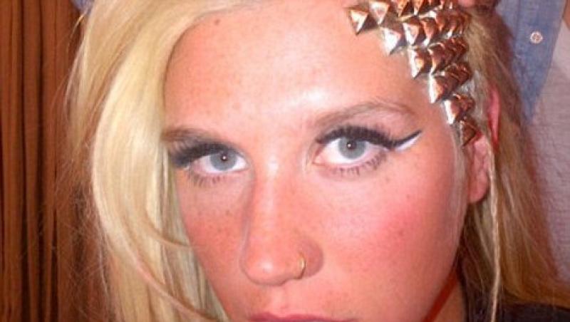 FOTO! Kesha, cu implant metalic in cap!