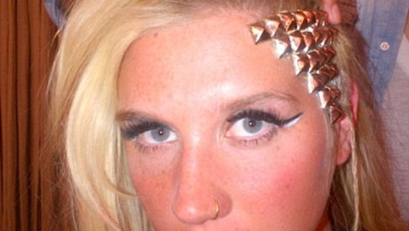 FOTO! Kesha, cu implant metalic in cap!