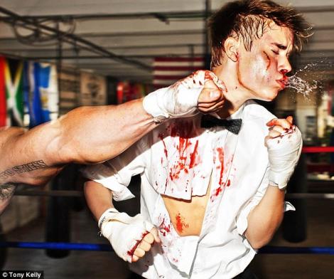 FOTO! SOC! Justin Bieber, batut, insangerat si cu hainele rupte