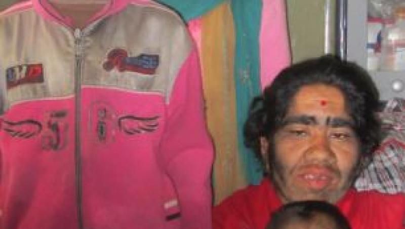 FOTO! Sindromul Varcolacului: Cea mai paroasa familie din Nepal