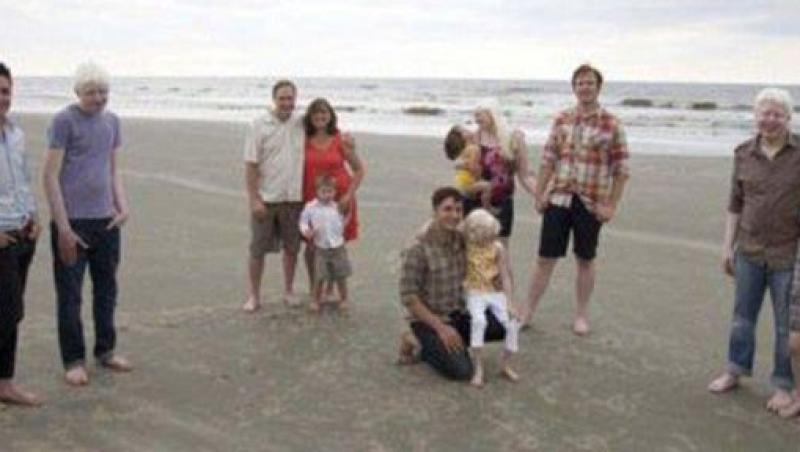 FOTO ULUITOR! Vezi familia cu patru copii albinosi!