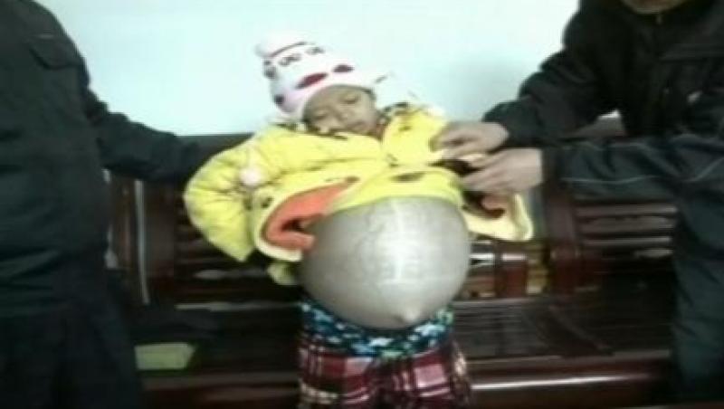 China: La 12 ani, o boala grava o face sa para ca e insarcinata!