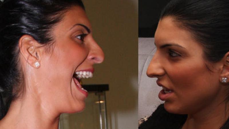 FOTO! Duelul nasurilor! Care vedeta autohtona ar trebui sa isi 