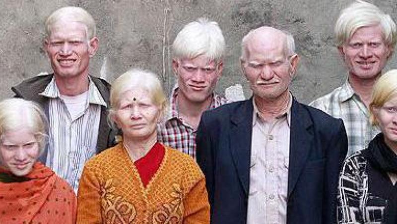 FOTO! Ei sunt membrii celui mai mare clan de albinosi