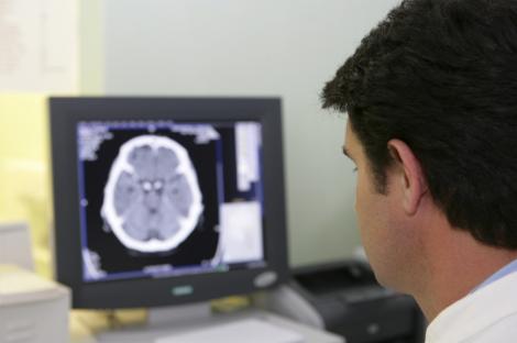 Accidentele vasculare cerebrale vor fi tratate in unitati mobile