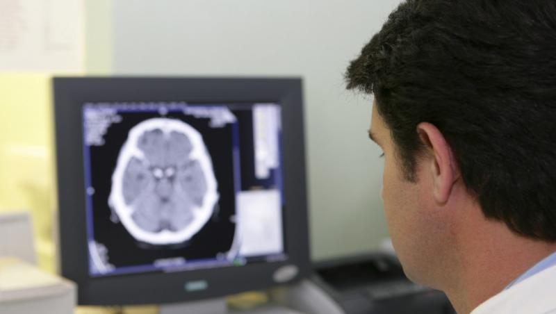 Accidentele vasculare cerebrale vor fi tratate in unitati mobile