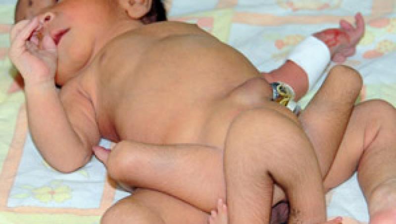 VIDEO! In Pakistan s-a nascut un bebelus cu sase picioare
