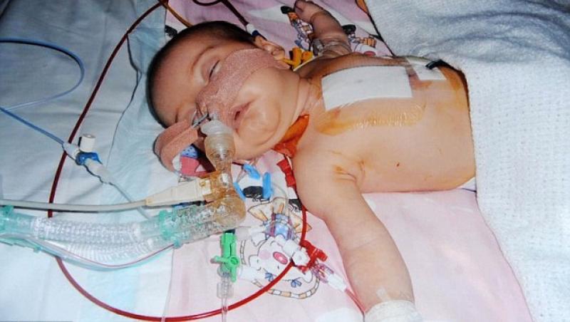 FOTO! Extraordinara recuperare a unui bebelus, dupa o operatie pe cord deschis