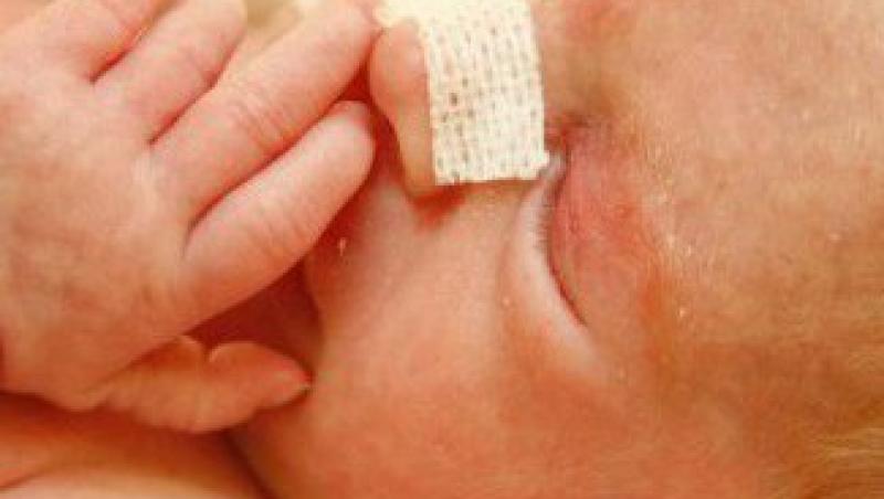 Copiii conceputi prin fertilizare in vitro, mai predispusi la malformatii