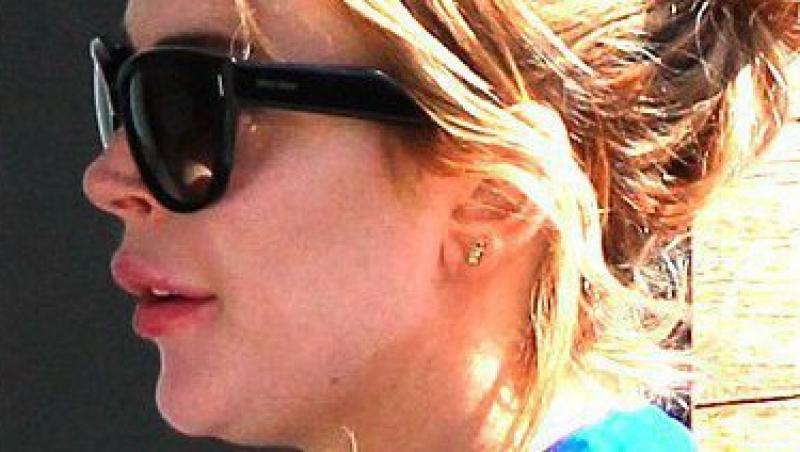 FOTO! Lindsay Lohan si-a distrus buzele de la atatea injectii