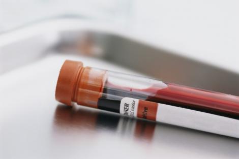 O analiza de sange va inlocui biopsiile pentru bolnavii de cancer