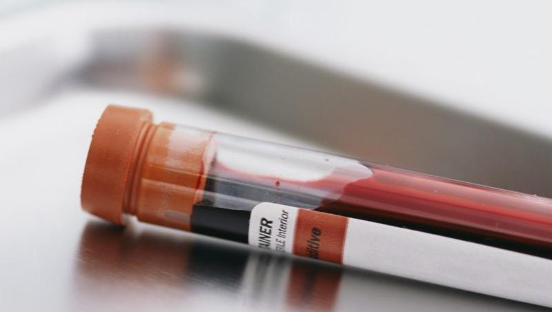 O analiza de sange va inlocui biopsiile pentru bolnavii de cancer