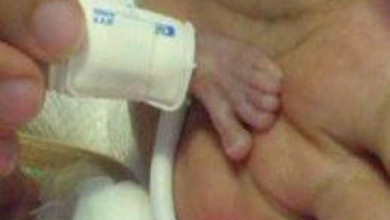 Cel mai mic bebelus din Brazilia s-a nascut cu o greutate de 340 de grame