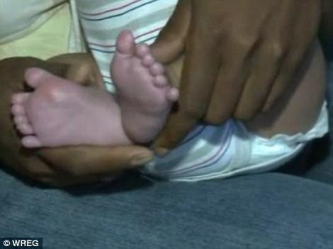 In SUA s-a nascut un baietel cu 12 degete fara ca medicii sa observe acest lucru