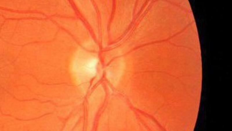 Redarea vederii va fi posibila in curand cu ajutorul celulelor stem