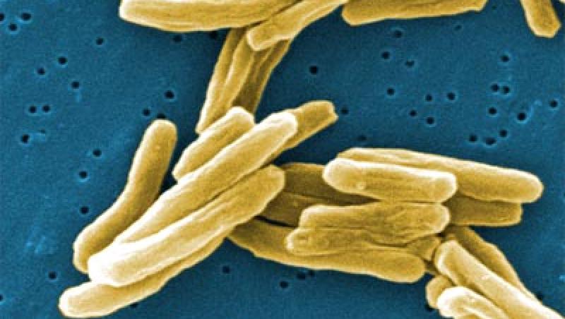 Un nou tratament pentru tuberculoza aduce speranta bolnavilor