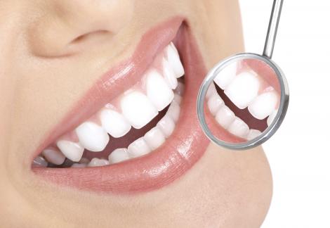 Statistica: Aproape 80% dintre romani au probleme dentare
