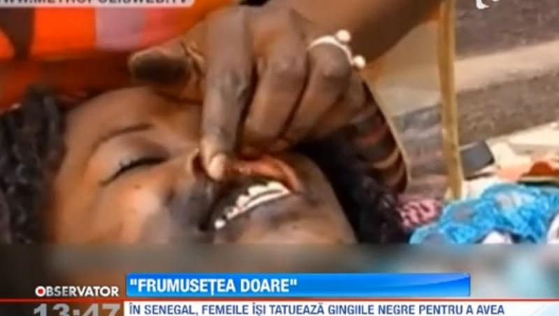 Tratament de infrumusetare socant in Senegal: Femeile isi tatueaza gingiile