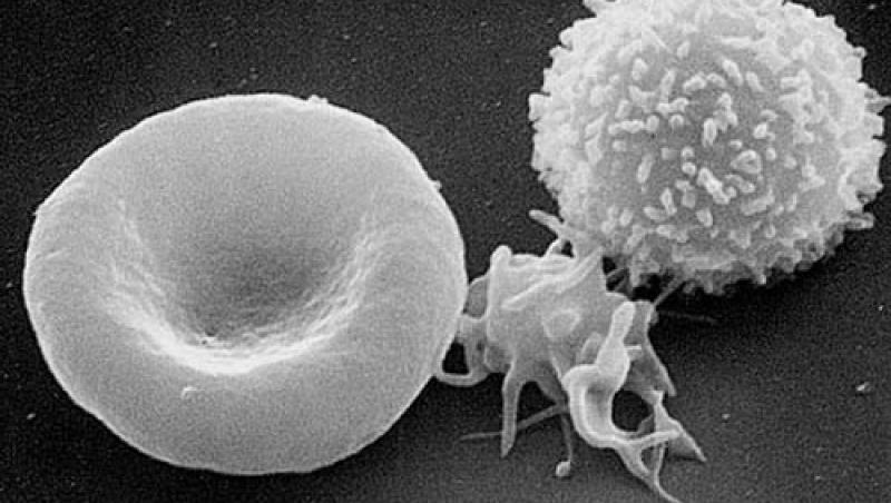 Cercetatorii japonezi au descoperit un tratament revolutionar anti-cancer