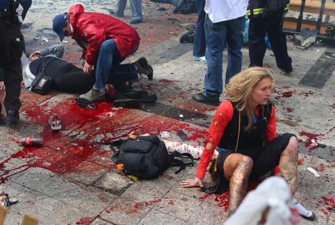 IMAGINI SOCANTE: Urmarile atacului terorist din Boston