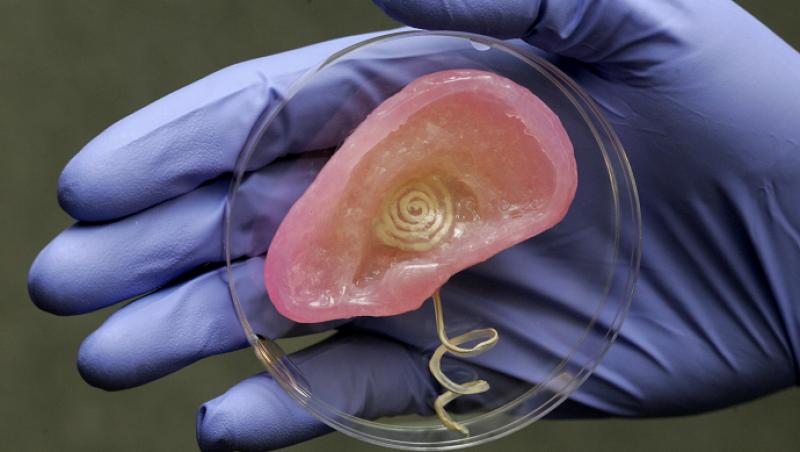 Cercetatorii de la Universitatea Princeton au realizat urechea bionica
