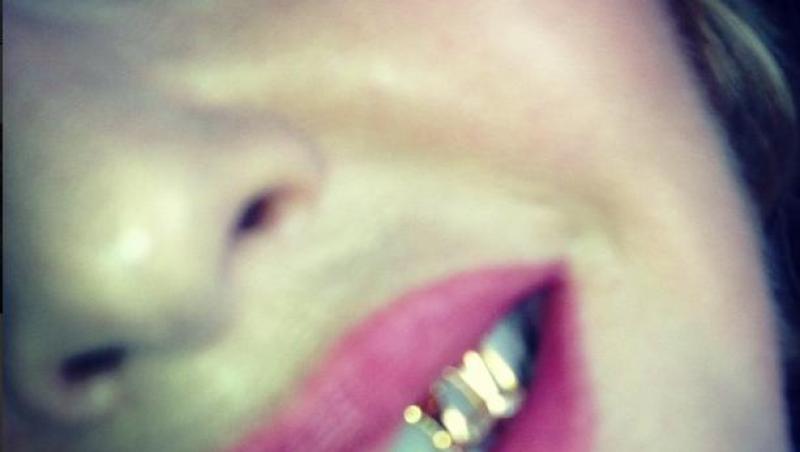 Madonna si-a imbracat dintii in aur si diamante