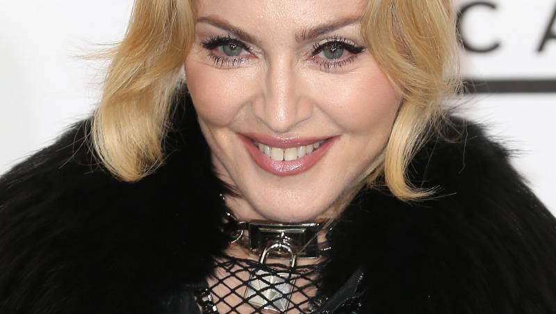 Madonna nu vrea sa renunte la aparatul dentar din aur