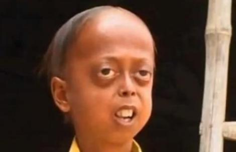 La 14 ani, un copil din India arata ca un batranel de 100! Parintii lui sunt veri primari