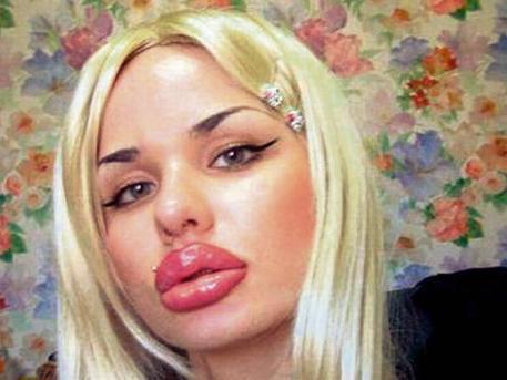 100 de operatii estetice pentru BUZE de Cartea Recordurilor