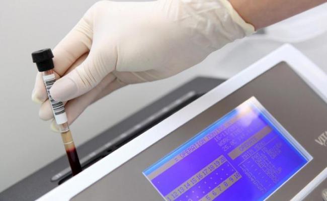 Raport ŞOCANT: Sute de analize pentru depistarea HIV şi sifilis, falsificate