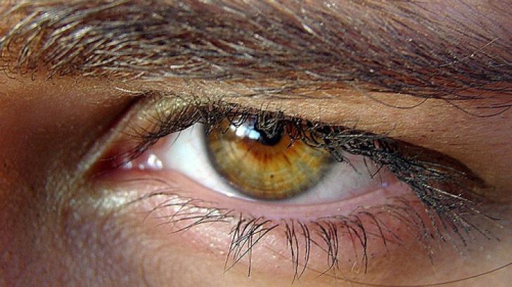 ŞOCANT: Cum arată ochii unui bărbat, după un şoc de 14.000 de volţi